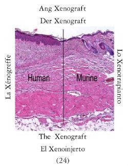 Xenotrapiantoi-1
