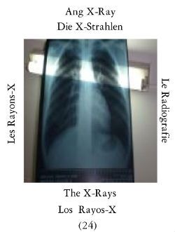 Xray